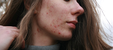 Bakterien & Biofilm